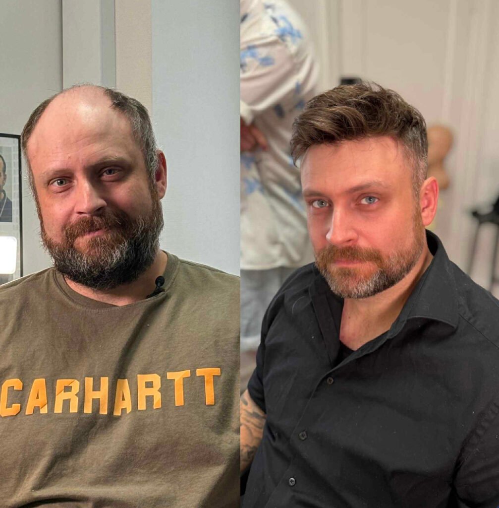 Fra kasket til selvtillid.